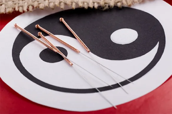 Βελονισμός: Ολιστική θεραπεία