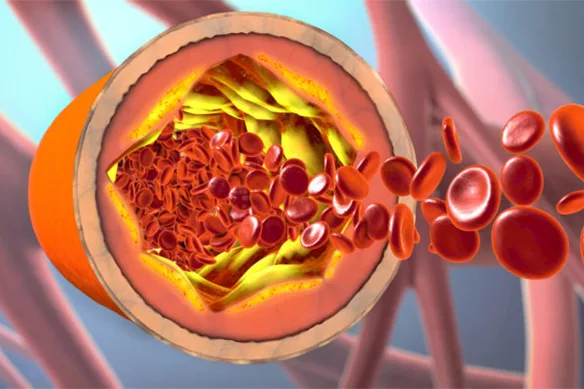 Χοληστερίνη: φίλος ή εχθρός;