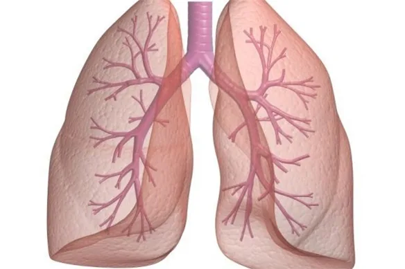 Οξεία Βρογχίτιδα