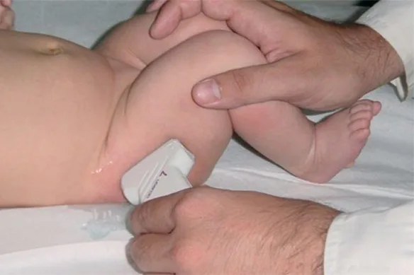 Το υπερηχογράφημα ισχίων νεογνών και βρεφών