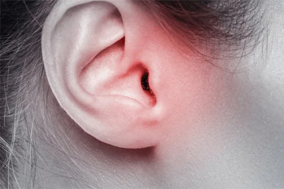 Πόνος στο αυτί