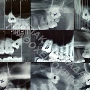 Παπαδάκη Κυριακή