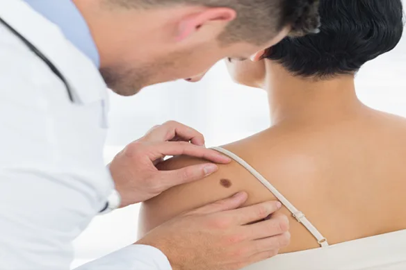 Πρόληψη Καρκίνου Δέρματος