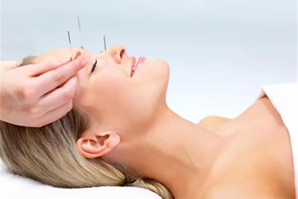 Βελονισμός: Θεραπεία και Πρόληψη